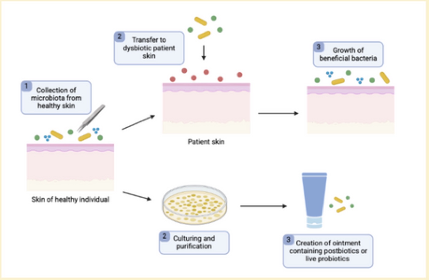Figure 2: Skin microbiome modulation strategies through transplantations and bacteriotherapy.