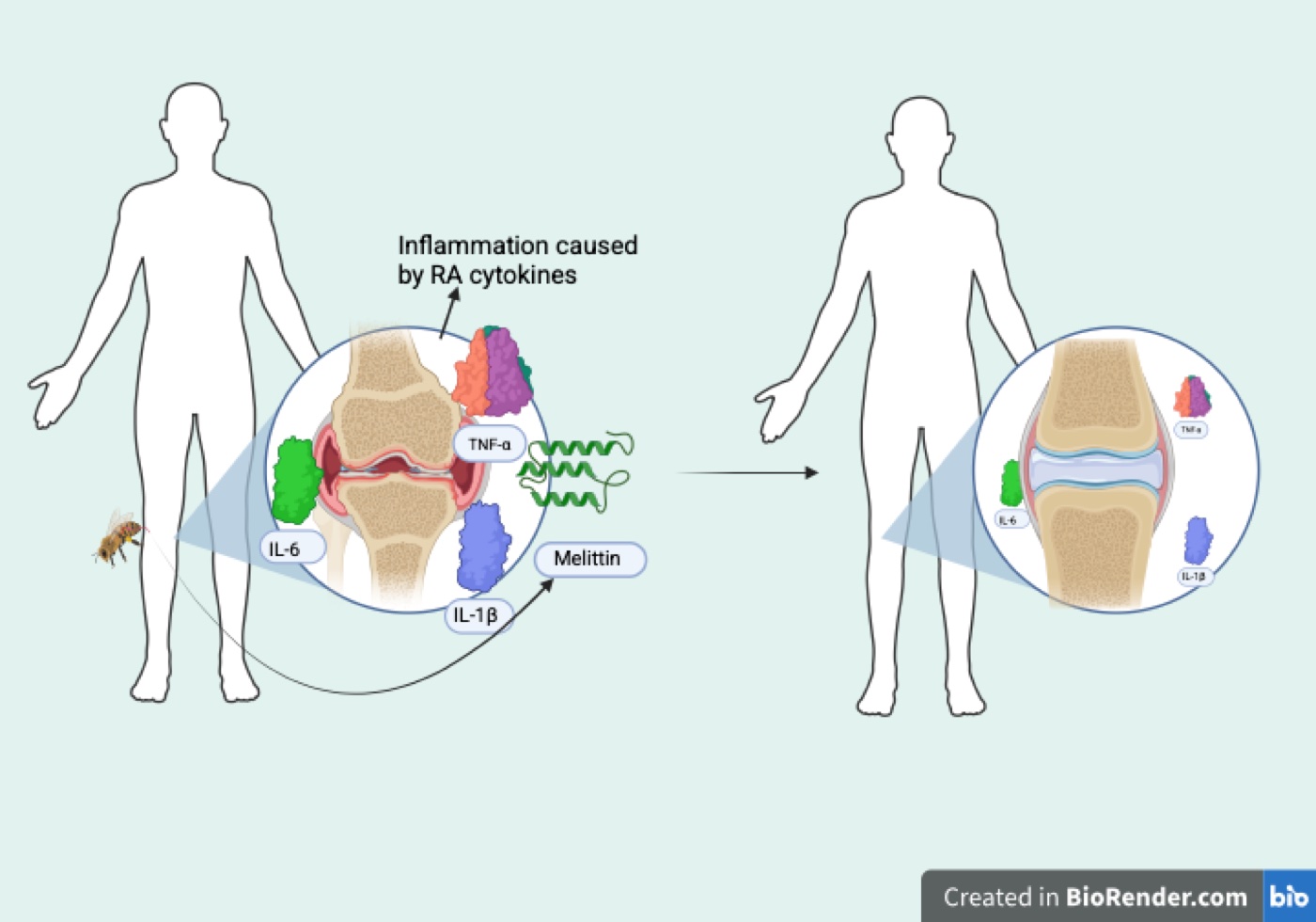 Diagram of two human body outlines. The left figure’s knee is magnified to show an inflamed joint surrounded by large TNF-alpha, IL-6, and IL-1-beta molecules, with a bee and a coiled melittin protein alongside. An arrow leads to the right figure, whose magnified knee looks healthier with much smaller cytokine molecules.